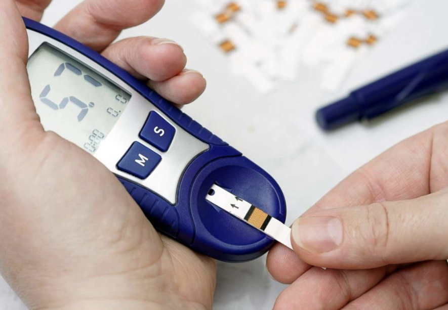 Faktor yang Dapat Mempengaruhi Kondisi Suatuvi